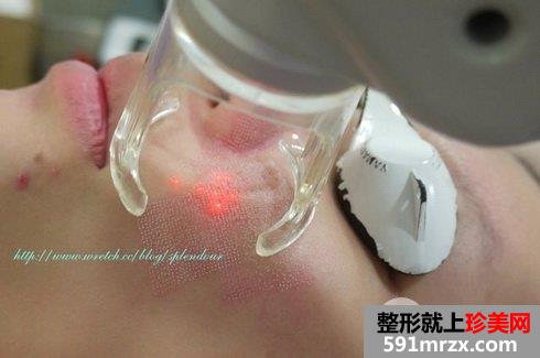�w�����䯟��