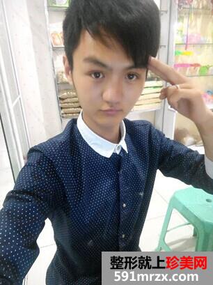 �ô��ޏ�ǰ�󌦱�Ч���DƬ���֏��^�̷���~
