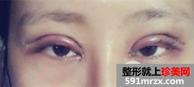 ��(n��i)�p��Ů��Ը���N�p��Ƥ�N ��Ȼ�����_(k��i)�p��Ƥ�g(sh��)3