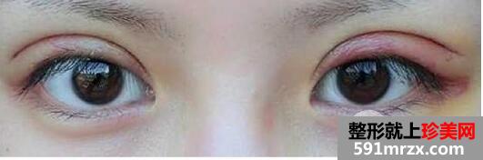 ȫ���p��Ƥ+�_�۽ǻ֏�ǰ�󌦱���Ƭ�D