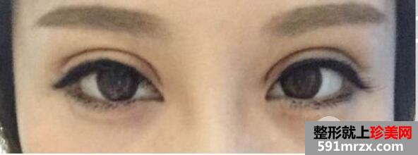 ȫ���p��Ƥ+�_�۽ǻ֏�ǰ�󌦱���Ƭ�D