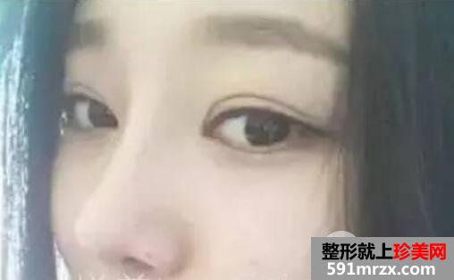 �ǾC���������g(sh��)�����挍(sh��)�֏�(f��)��(j��ng)�v��ȻЧ���D