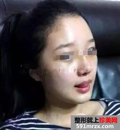 �ǾC���������g(sh��)�����挍(sh��)�֏�(f��)��(j��ng)�v��ȻЧ���D