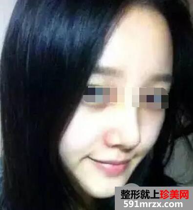 �ǾC���������g(sh��)�����挍(sh��)�֏�(f��)��(j��ng)�v��ȻЧ���D