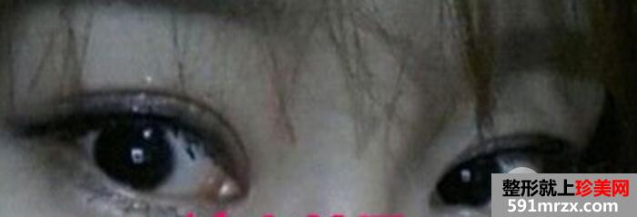 �p��Ƥ�ޏ�(f��)���g(sh��)�������p��Ƥʧ����С��