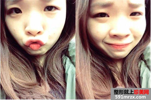 �g(sh��)ǰ����Ƥ��Ƭ