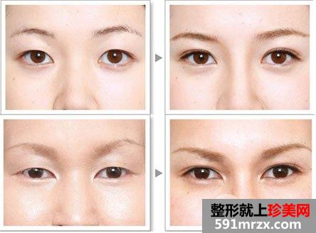 �p��Ƥ�������g(sh��)���������L(f��ng)�U��һ������F(xi��n)ʲô��r