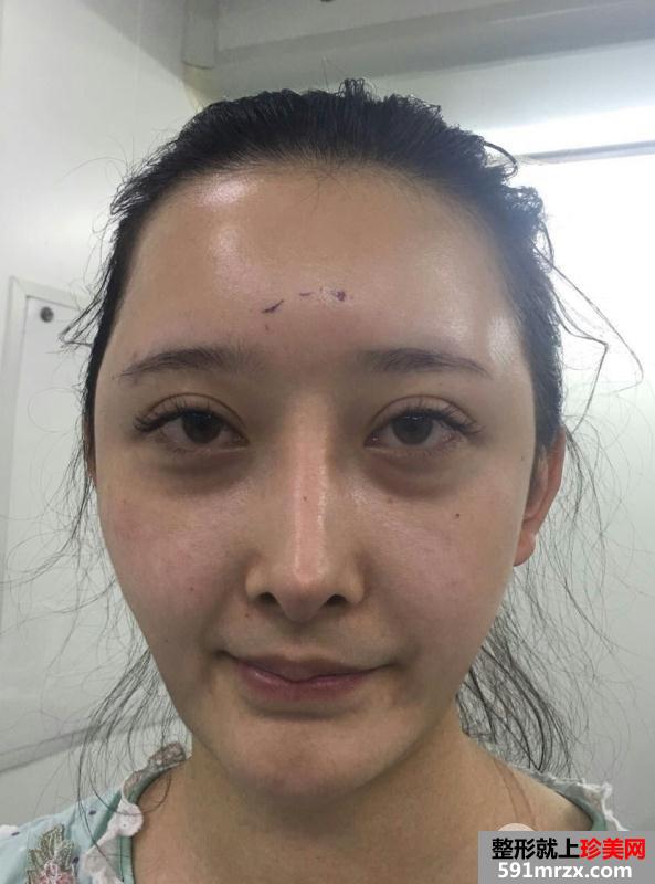 ���w֬���沿����������ͯ����˰�����(du��)�ȈD����