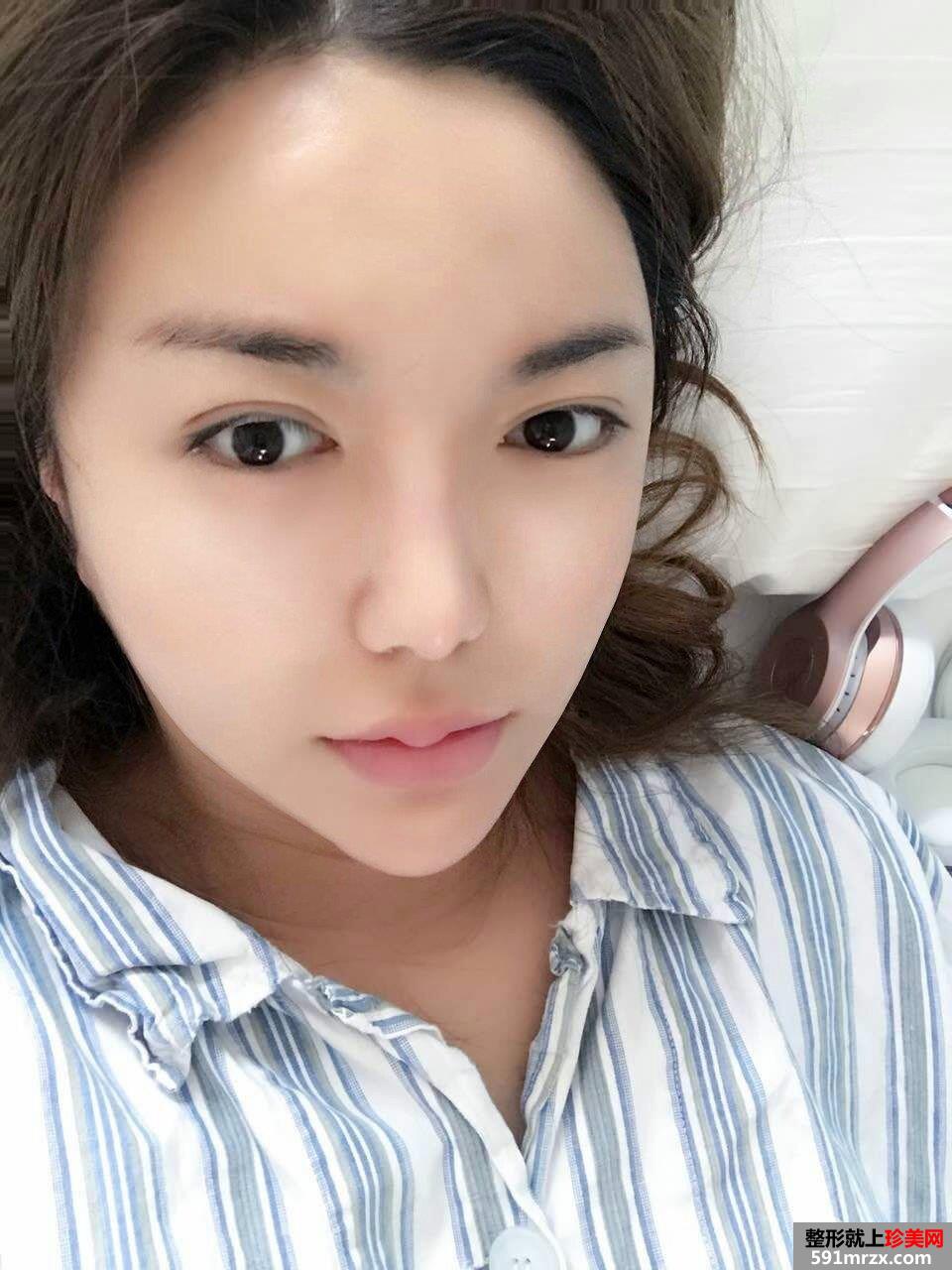�沿��֬��Ę�挍������������֬ǰ�󌦱ȈD