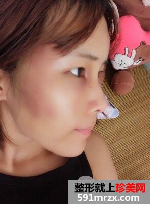 ���w֬���沿����沿�����挍(sh��)��������ͯ���Ů