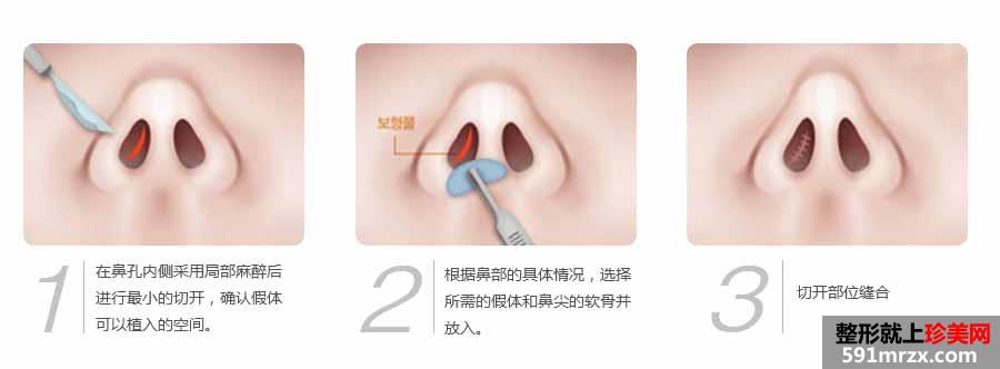 �m����̩�����t(y��)Ժ�r���2017���ع�