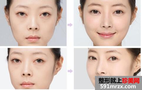 蘭州時(shí)光激光整形美容醫(yī)院價(jià)格表新曝光