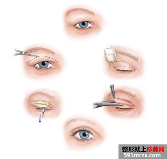 蘭州美月整形美容醫(yī)院價(jià)格表新曝光