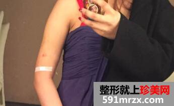 �ֱ۳�֬�����X(qi��n)?�����Ҵ��ֱ۳�֬���H����(j��ng)�v��