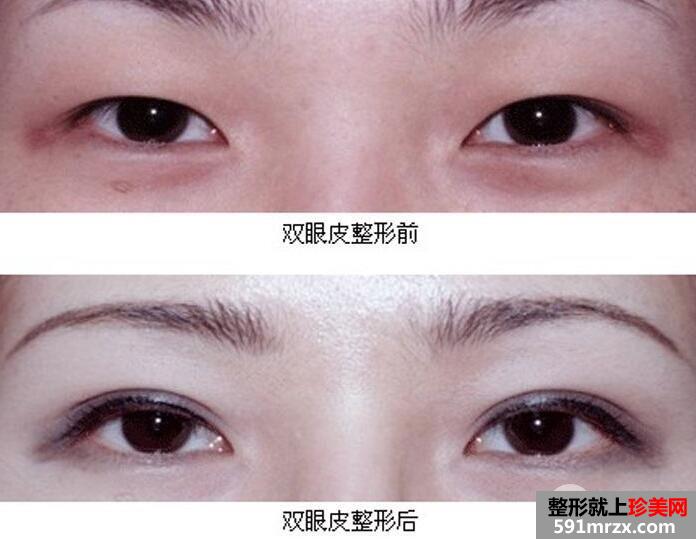 ��h���������t(y��)Ժ��ַ�̓r(ji��)���