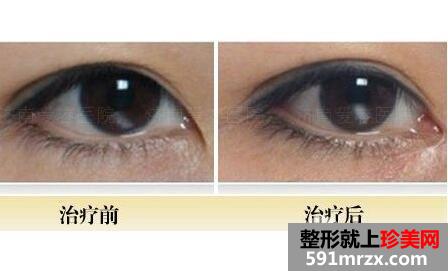 �_�۽����ΰ�ȫ��?