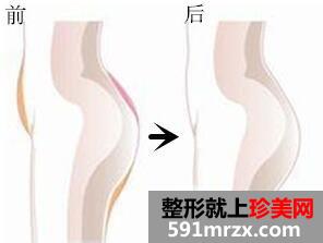 ���w֬���S�ζ����X?����ȱ�c(di��n)?Ч���D