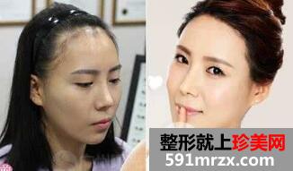 �l(f��)�H��(xi��n)�Nֲ������Ó��᣿
