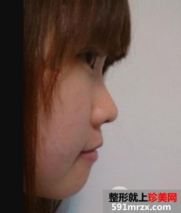 ���������x��������{(l��n)������¡�ǃr(ji��)�����F��Ч����