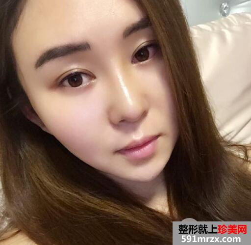 ���˼��w¡�Ǻ͉|�Ǽ�ıǾC�ϱ������λ֏��^�̈D