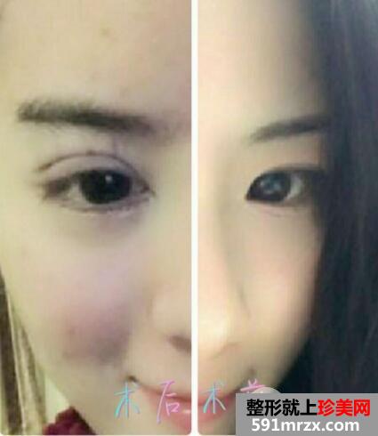 �nʽ���c(di��n)��λ�p��Ƥ�r(ji��)��ͻ֏�(f��)�^�̈D����Ч���ܺ�