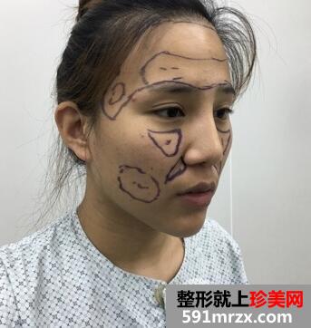 ��ꖐ�˼���tԺ���΃r���,�����w֬����䰸��Ч���DƬ~