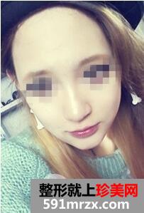 �p������7