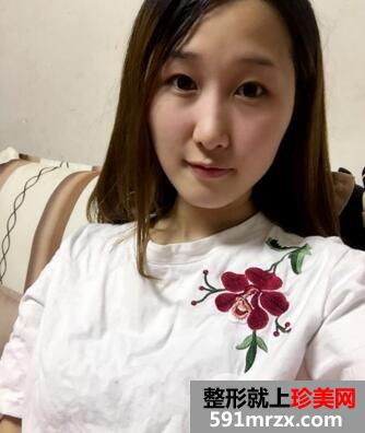 �ؑc܊���p��Ƥ+�沿����������挍Ч����������