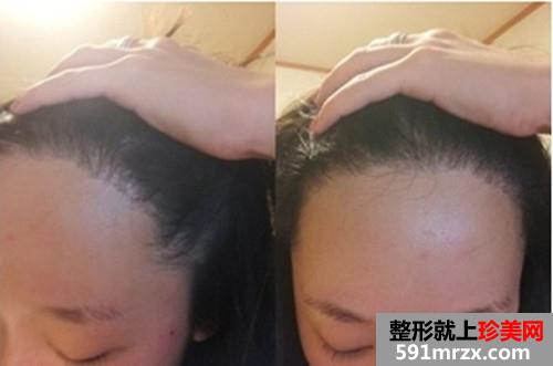 �l(f��)�H���Nֲ���g(sh��)ǰ��Ч����(du��)�ȈD�ͻ֏�(f��)�^(gu��)��