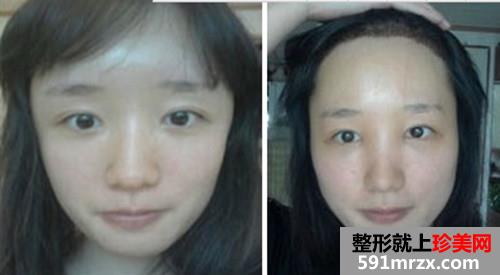 �l(f��)�H���Nֲ���g(sh��)ǰ��Ч����(du��)�ȈD�ͻ֏�(f��)�^(gu��)��