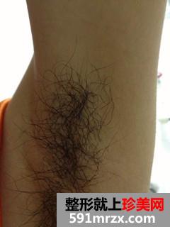 ����ÓҸë�и����Æ᣿�����ҵ�ǰ�󌦱ȈD�ͻ֏�(f��)�^�̰ɣ�