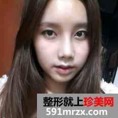 ���w֬���沿�������+�C��¡�� Ч���D����