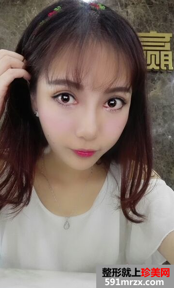 �ű�����p��Ƥ���gǰ�󌦱�Ч���DƬ�ͻ֏��^��