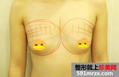 ���w֬����ֲ¡���g(sh��) ���������ز�����