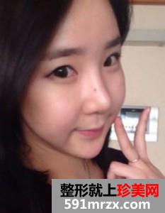 �沿,��֬,��Ę,���g(sh��),�֏�(f��),�^��,ǰ��,����,Ч��,�DƬ