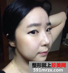 �沿,��֬,��Ę,���g(sh��),�֏�(f��),�^��,ǰ��,����,Ч��,�DƬ