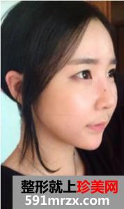 �沿,��֬,��Ę,���g(sh��),�֏�(f��),�^��,ǰ��,����,Ч��,�DƬ