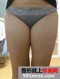 �Ȳ����w��֬�gǰ�󌦱�Ч���D�ͻ֏��挍���v