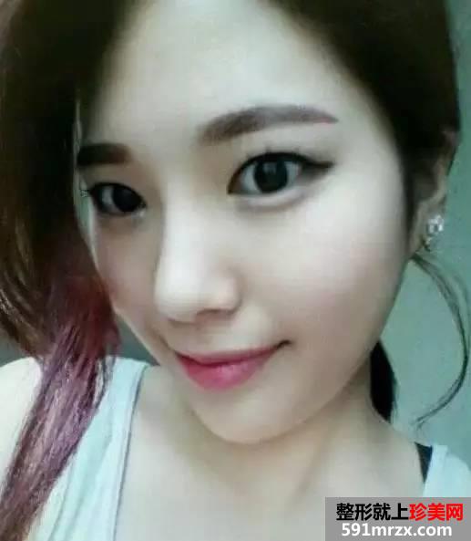 ���w֬������~�^+���aǰ��(du��)��Ч���DƬ�ͻ֏�(f��)�^(gu��)��