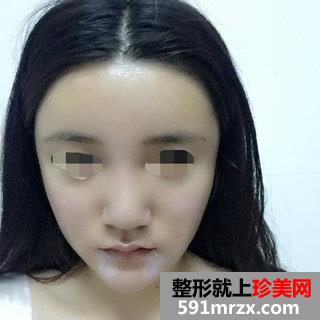 ���w֬���沿�����Ă�(g��)��Ч���D����
