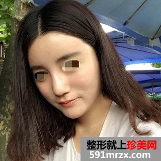 ���w֬���沿�����Ă�(g��)��Ч���D����
