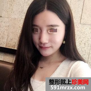 ���w֬���沿�����Ă�(g��)��Ч���D����
