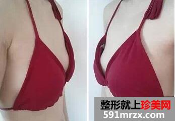 230cc�ļ��w �ΑB(t��i)���ָ�Ч�����ܺ�