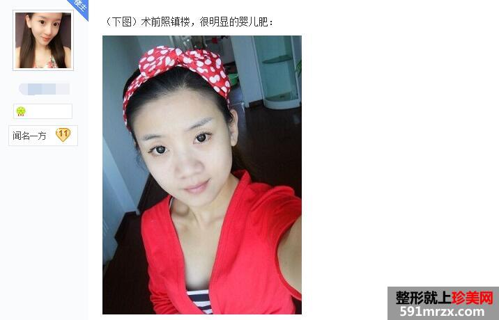 �N�ɷ������沿��֬�p���^�� �Ћ냺�ʵĿ��^��