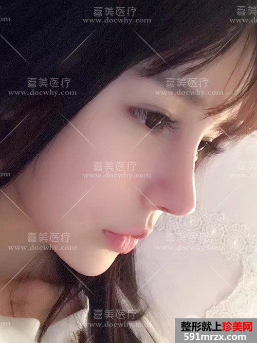 �ǲ��ޏ�(f��)+֬��ȫĘ����g(sh��)��2��(g��)����|����ǰ�󌦱ȈD