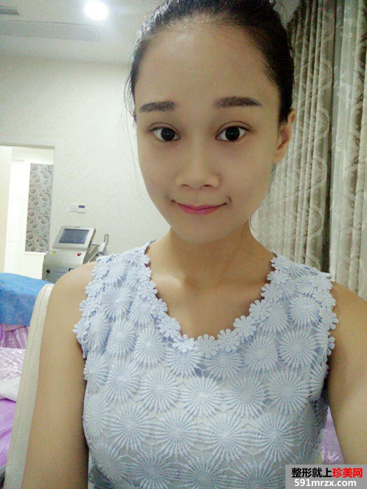 ��һ���ҵ�ȫ���p��Ƥ�֏�(f��)�^(gu��)��