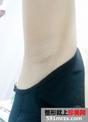 ��(gu��)polytechˮ���ͼ��w¡��ǰ��Ч����(du��)�ȈD�ͻ֏�(f��)�^(gu��)��