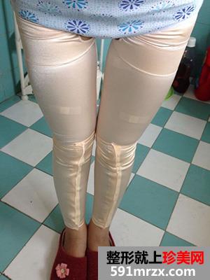 ���l��֬�ݴ����挍(sh��)����������ǰ�󌦱���