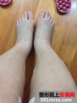 ���l��֬�ݴ����挍(sh��)����������ǰ�󌦱���
