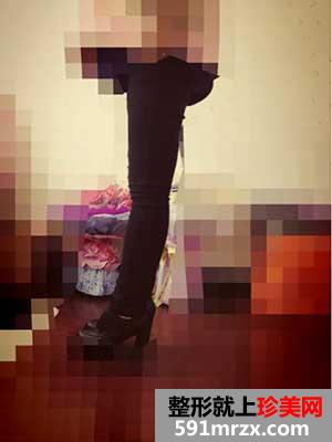 ����+�β���֬���g(sh��)ǰ��Ч����(du��)�ȈD�ͻ֏�(f��)�^(gu��)��